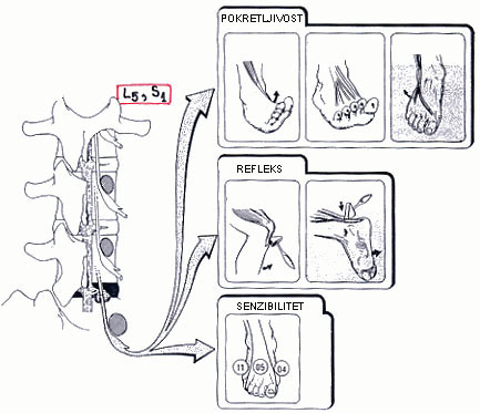 Prelom C4 vratnog pr�ljena